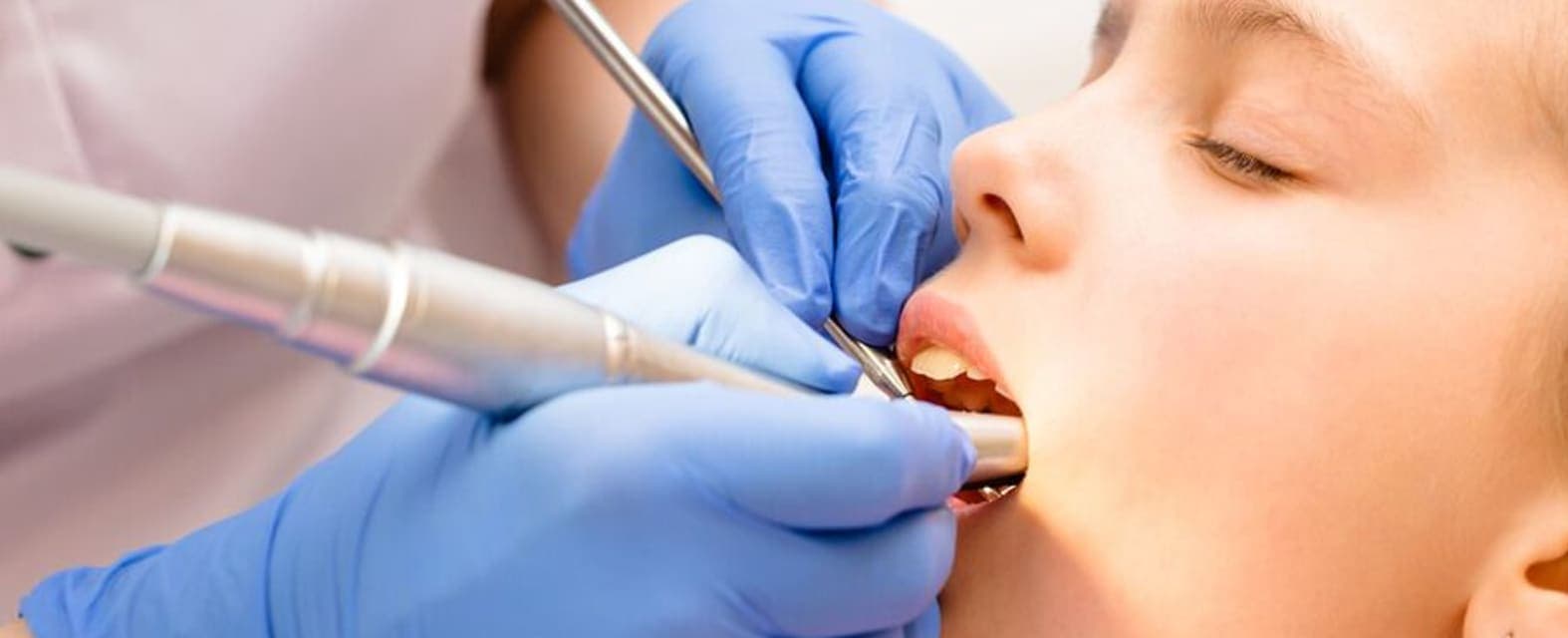 Sacramento Pediatric Dentists